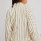 Devon Balloon Stripped Jacket